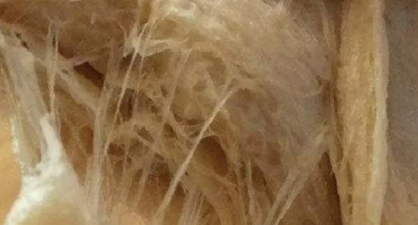 सोया प्रोटीन का उपयोग सोया प्रोटीन का उपयोग